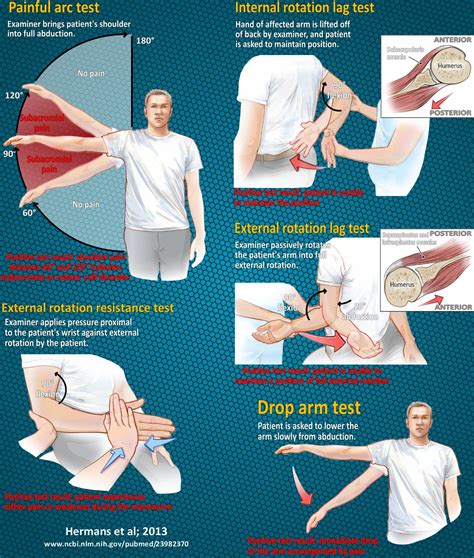 positive rotator cuff tests